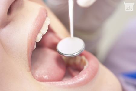 Klimavi zubi – Parodntoza