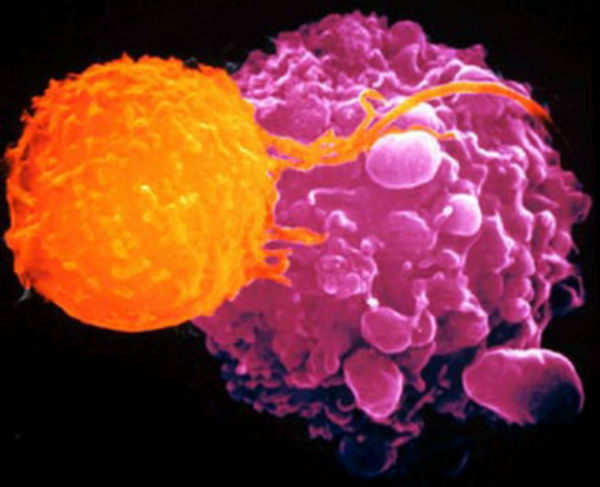 Uloga imuniteta u odbrani od tumora