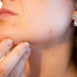 Alergijski kontaktni dermatitis: najčešći uzročnici
